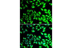 Immunofluorescence analysis of U20S cell using PDIA6 antibody. (PDIA6 抗体)