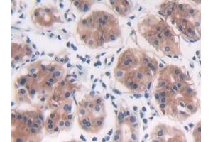 Immunohistochemistry (IHC) image for anti-Protein tyrosine Phosphatase, Receptor Type, B (PTPRB) (AA 1655-1918) antibody (ABIN7439990)