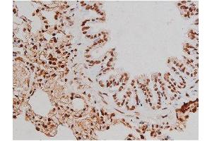 Immunohistochemistry (IHC) image for anti-Mast/stem Cell Growth Factor Receptor (KIT) (pTyr721) antibody (ABIN6256004)