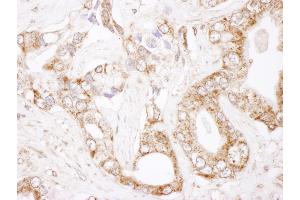 Immunohistochemistry (IHC) image for anti-B-Cell CLL/lymphoma 2 (BCL2) (AA 50-100) antibody (ABIN7454495)