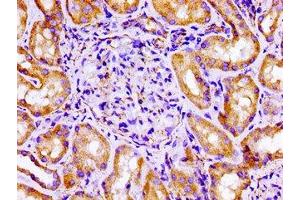 Immunohistochemistry of paraffin-embedded human kidney tissue using ABIN7152944 at dilution of 1:100 (Filamin A 抗体  (AA 1234-1462))