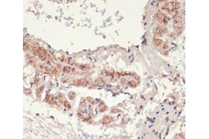 Immunohistochemistry of paraffin-embedded Rat lung using ADRA1A Polyclonal Antibody at dilution of 1:100 (40x lens). (alpha 1 Adrenergic Receptor 抗体)
