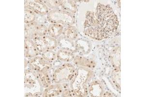 Immunohistochemical staining of human kidney with TSR1 polyclonal antibody  shows nuclear positivity in tubules and glomeruli.