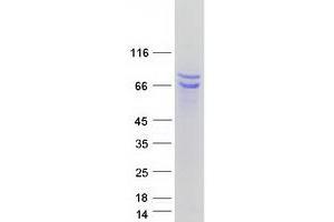 Validation with Western Blot
