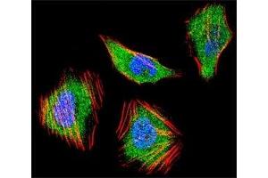 Fluorescent confocal image of HeLa cell stained with SMAD4 antibody at 1:25. (SMAD4 抗体  (AA 400-428))