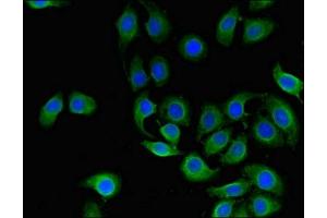 Immunofluorescent analysis of A549 cells using ABIN7147114 at dilution of 1:100 and Alexa Fluor 488-congugated AffiniPure Goat Anti-Rabbit IgG(H+L) (CD151 抗体  (AA 125-199))