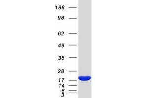 Western Blotting (WB) image for Non-Metastatic Cells 1, Protein (NM23A) Expressed in (NME1) (Transcript Variant 1) protein (Myc-DYKDDDDK Tag) (ABIN2726966)