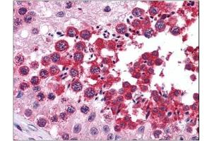 Human Testis: Formalin-Fixed, Paraffin-Embedded (FFPE) (RUVBL2 抗体  (Ser129))