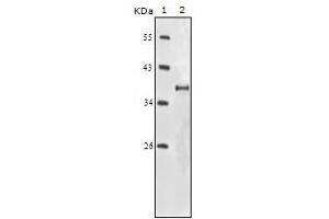 Western Blot showing IGF1R antibody used against truncated IGF1R recombinant protein. (IGF1R 抗体)