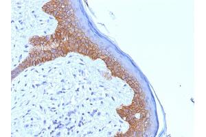 Formalin-fixed, paraffin-embedded human Skin stained with Desmoglein-3 Monoclonal Antibody (5G11). (Desmoglein 3 抗体)