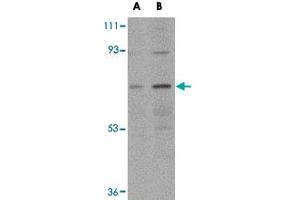 Western blot analysis of NOTUM in human kidney tissue lysate with NOTUM polyclonal antibody  at (A) 0.