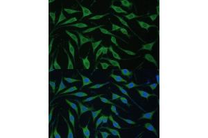 Immunofluorescence analysis of L929 cells using FB antibody (ABIN7267107) at dilution of 1:100. (FAM127B 抗体  (AA 1-113))