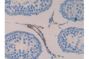 Immunohistochemistry (IHC) image for anti-SMAD, Mothers Against DPP Homolog 1 (SMAD1) (AA 273-468) antibody (ABIN1078329)