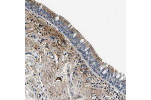 Immunohistochemical staining of human bronchus with TMEM186 polyclonal antibody  shows moderate cytoplasmic and membranous positivity in respiratory epithelial cells at 1:50-1:200 dilution. (TMEM186 抗体)