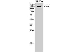 Western Blotting (WB) image for anti-Nitric Oxide Synthase 2, Inducible (NOS2) (Thr177) antibody (ABIN3176385) (NOS2 抗体  (Thr177))