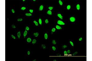 Immunofluorescence of monoclonal antibody to HES1 on HeLa cell. (HES1 抗体  (AA 36-142))