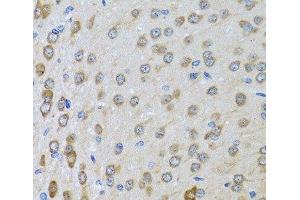 Immunohistochemistry of paraffin-embedded Rat brain using BTD Polyclonal Antibody at dilution of 1:100 (40x lens). (BTD 抗体)