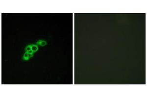 Immunofluorescence analysis of MCF-7 cells, using FSHR antibody. (FSHR 抗体  (Internal Region))