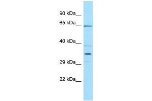 WB Suggested Anti-CFHR5 Antibody Titration: 1. (CFHR5 抗体  (N-Term))