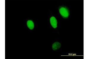 Immunofluorescence of purified MaxPab antibody to NPLOC4 on HeLa cell. (NPLOC4 抗体  (AA 1-608))
