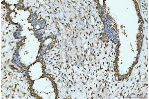 IHC analysis of EXOSC8 using anti-EXOSC8 antibody (ABIN7601850).