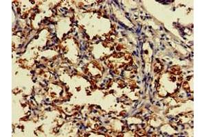 Immunohistochemistry of paraffin-embedded human lung tissue using ABIN7149454 at dilution of 1:100 (DDO 抗体  (AA 37-161))