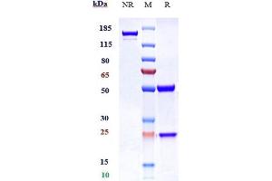 Anti-ERBB3 / HER3 Reference Antibody (patritumab) on SDS-PAGE under reducing (R) condition. (Recombinant ErbB3 (Patritumab Biosimilar) 抗体)