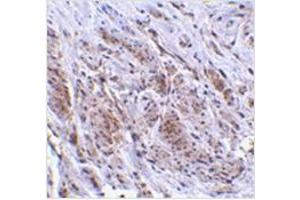 Immunohistochemistry of TRIM5 gamma in human bladder tissue with TRIM5 gamma antibody at 2 μg/ml. (TRIM5 抗体  (C-Term, Isoform gamma))