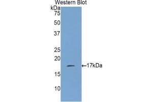 Western blot analysis of the recombinant protein. (IL-17 抗体  (AA 21-153))