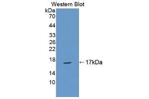 Detection of Recombinant TNP2, Mouse using Polyclonal Antibody to Transition Protein 2 (TNP2)