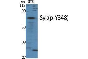 Western Blot (WB) analysis of specific cells using Phospho-Syk (Y348) Polyclonal Antibody. (SYK 抗体  (pTyr348))