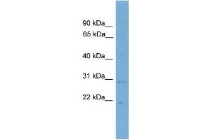 WB Suggested Anti-CNPY3 Antibody Titration: 0. (TNRC5 抗体  (N-Term))