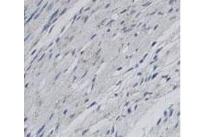 Staining of Scarb2 in rat infarctzone tissue using Scarb2 polyclonal antibody  with a DAB detection system. (SCARB2 抗体)