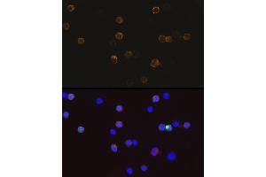 Immunofluorescence analysis of 293T-BC-Flag-GFP-C cells using Mouse anti DDDDK-Tag mAb (ABIN3020558, ABIN3020559, ABIN3020560 and ABIN1512923) at dilution of 1:100 (40x lens).