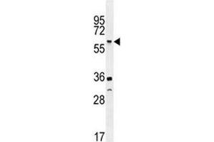 TNFR antibody western blot analysis in U251 lysate.