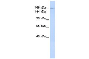 WB Suggested Anti-ZNF646 Antibody Titration:  0. (ZNF646 抗体  (N-Term))