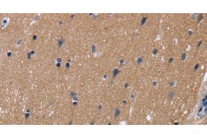 Immunohistochemistry of paraffin-embedded Human brain tissue using KCNJ11 Polyclonal Antibody at dilution 1:40 (KCNJ11 抗体)