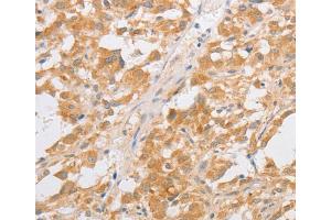 Immunohistochemistry (IHC) image for anti-CDKN2A Interacting Protein (CDKN2AIP) antibody (ABIN2421961) (CDKN2AIP 抗体)