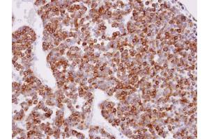 IHC-P Image Immunohistochemical analysis of paraffin-embedded human pituitary gland tumor, using XPR1, antibody at 1:100 dilution.