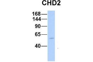 Host:  Rabbit  Target Name:  CHD2  Sample Type:  Human Fetal Muscle  Antibody Dilution:  1.