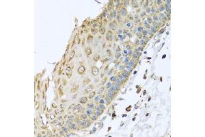 Immunohistochemistry of paraffin-embedded human esophagus using ARFGAP3 antibody (ABIN5974520) at dilution of 1/100 (40x lens). (ARFGAP3 抗体)