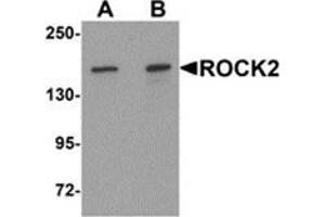 Western blot analysis of ROCK2 in mouse brain tissue lysate with ROCK2 antibody at (A) 1 and (B) 2 μg/ml (ROCK2 抗体  (Center))