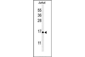 Western blot analysis in Jurkat cell line lysates (35 ug/lane) using RPS25 Antibody (N-term) Cat.