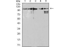 Western blot analysis using ZFP91 mouse mAb against Jurkat (1), A431 (2), HepG2 (3), HEK293 (4), and A549 (5) cell lysate. (ZFP91 抗体  (AA 162-304))