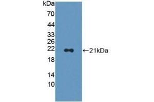 Detection of Recombinant CAP2, Human using Polyclonal Antibody to Adenylyl Cyclase Associated Protein 2 (CAP2) (CAP2 抗体  (AA 317-455))