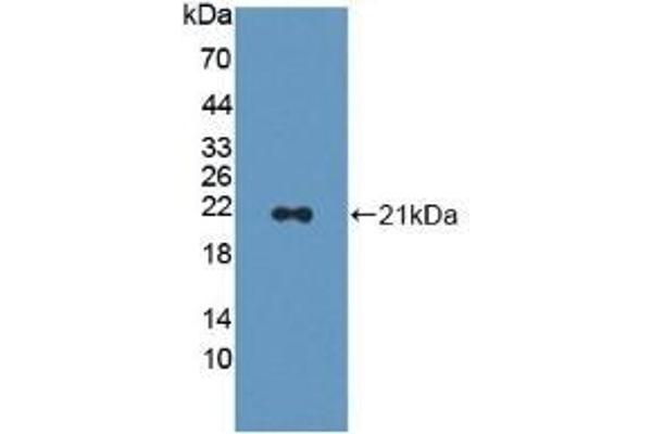 CAP2 Antikörper  (AA 317-455)