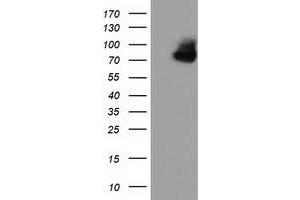 Western Blotting (WB) image for anti-Oxysterol Binding Protein-Like 11 (OSBPL11) antibody (ABIN1499919) (OSBPL11 抗体)