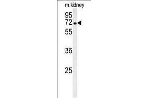 Western blot analysis in mouse kidney tissue lysates (35ug/lane). (GNE 抗体  (C-Term))