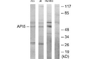 Immunohistochemistry analysis of paraffin-embedded human heart tissue using API-5 antibody. (Apoptosis Inhibitor 5 抗体)