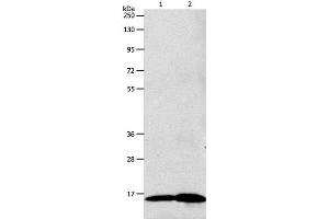 Western Blot analysis of 293T cell and Human fetal brain tissue using LHB Polyclonal Antibody at dilution of 1:800 (LHB 抗体)